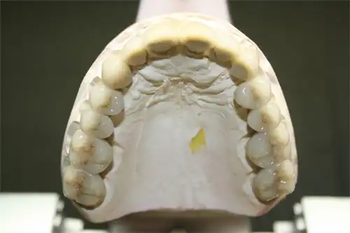 Model of a set of lower teeth